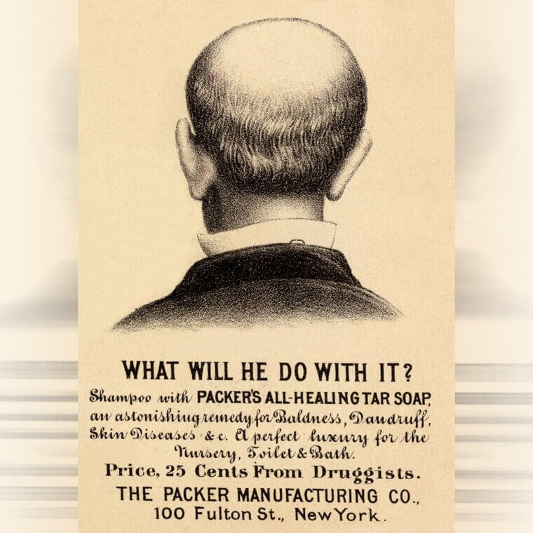Male Baldness Was Treated With Chicken Excrement