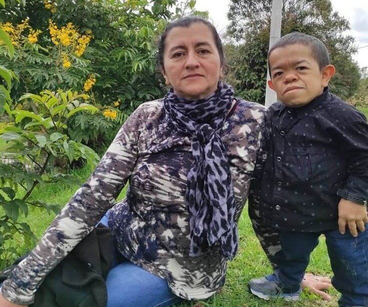 The World's Shortest Living Human
